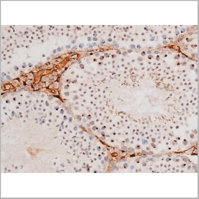 product-image-AAA31062_IHC8.jpg