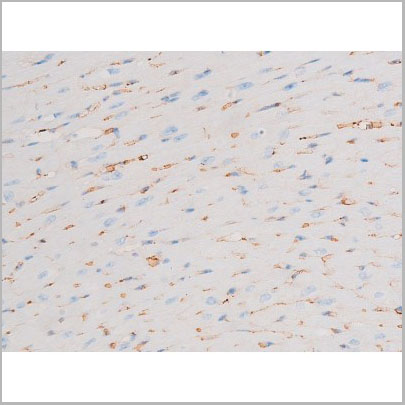 product-image-AAA31064_IHC3.jpg