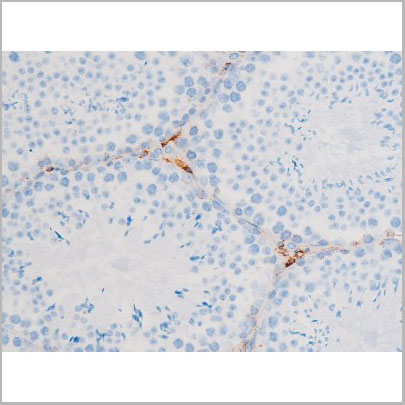 product-image-AAA31064_IHC4.jpg