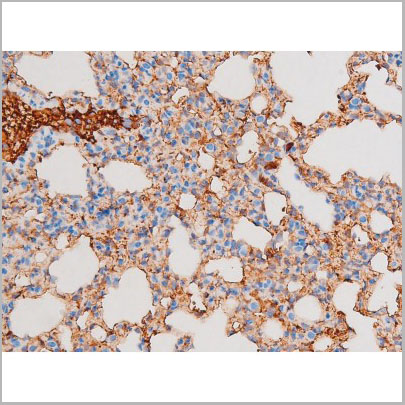 product-image-AAA31064_IHC5.jpg