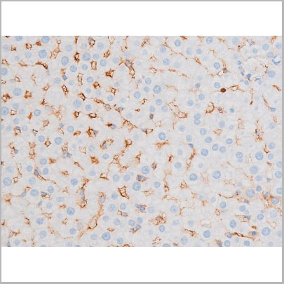 product-image-AAA31064_IHC6.jpg