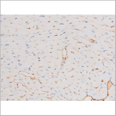product-image-AAA31065_IHC3.jpg
