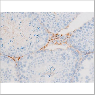 product-image-AAA31065_IHC4.jpg