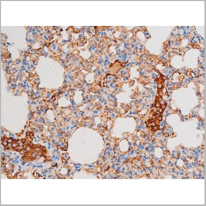 product-image-AAA31065_IHC5.jpg