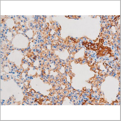 product-image-AAA31065_IHC6.jpg