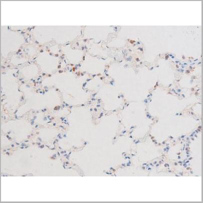 product-image-AAA31065_IHC7.jpg