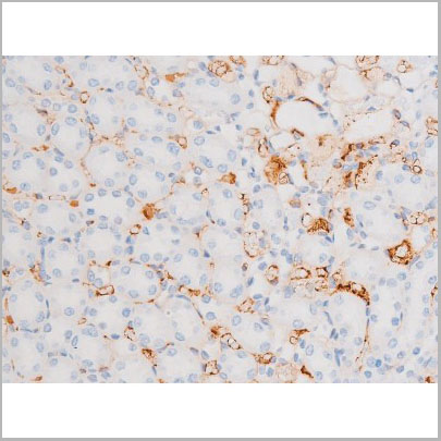 product-image-AAA31065_IHC8.jpg