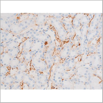 product-image-AAA31065_IHC9.jpg