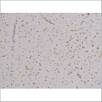 product-image-AAA31066_IHC3.jpg