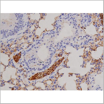 product-image-AAA31066_IHC5.jpg