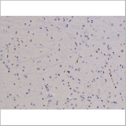 product-image-AAA31066_IHC6.jpg