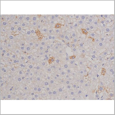 product-image-AAA31066_IHC8.jpg