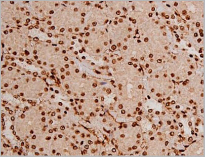 product-image-AAA31067_IHC15.jpg