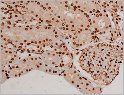 product-image-AAA31067_IHC16.jpg