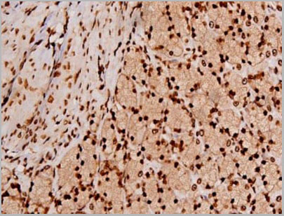 product-image-AAA31067_IHC17.jpg