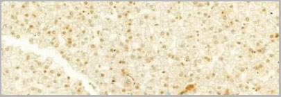 product-image-AAA31067_IHC19.jpg