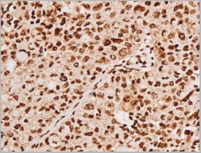 product-image-AAA31067_IHC3.jpg