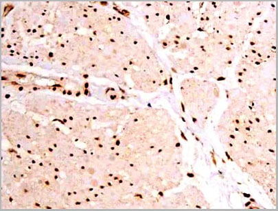 product-image-AAA31067_IHC5.jpg