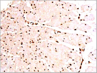 product-image-AAA31067_IHC6.jpg