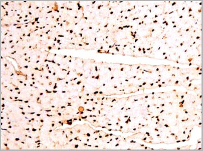 product-image-AAA31067_IHC7.jpg