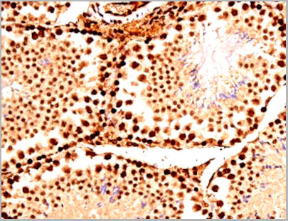 product-image-AAA31067_IHC9.jpg