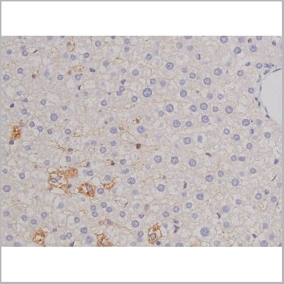 product-image-AAA31068_IHC12.jpg