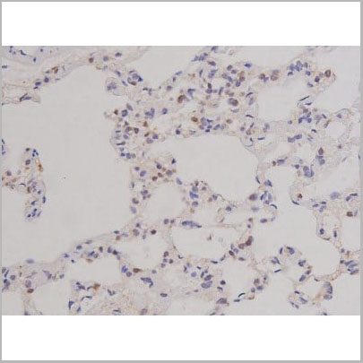 product-image-AAA31068_IHC14.jpg