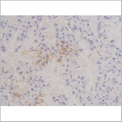 product-image-AAA31068_IHC5.jpg