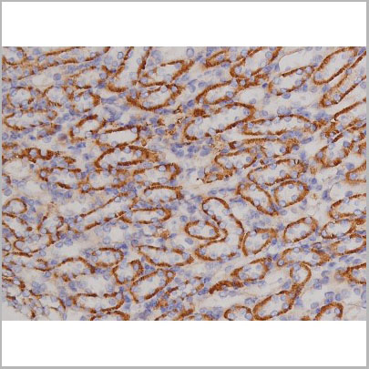product-image-AAA31068_IHC6.jpg