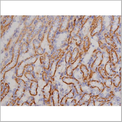product-image-AAA31068_IHC7.jpg