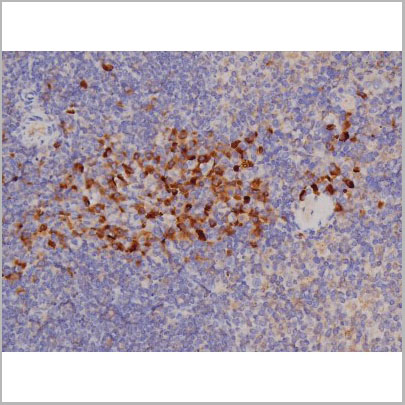 product-image-AAA31068_IHC8.jpg