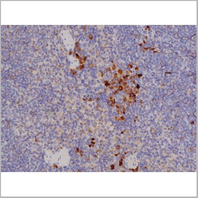 product-image-AAA31068_IHC9.jpg