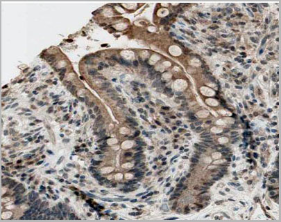 product-image-AAA31070_IHC5.jpg