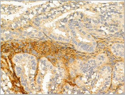 product-image-AAA31070_IHC6.jpg