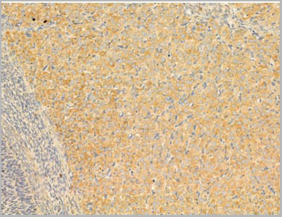 product-image-AAA31070_IHC7.jpg