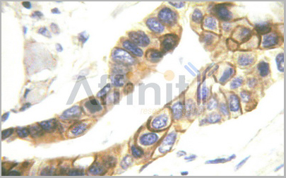product-image-AAA31071_IHC2.jpg