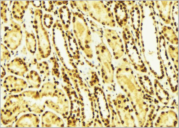 product-image-AAA31071_IHC4.jpg