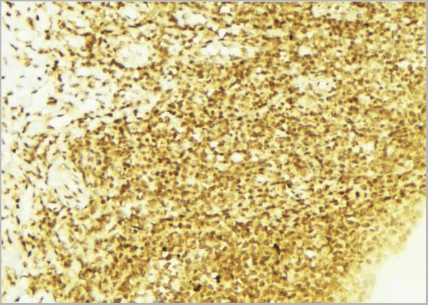product-image-AAA31072_IHC4.jpg