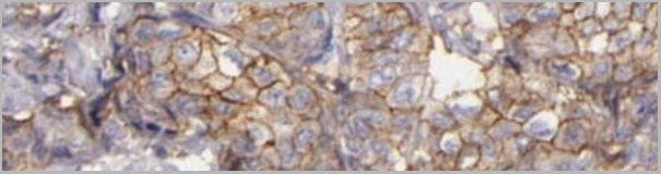 product-image-AAA31074_IHC4.jpg
