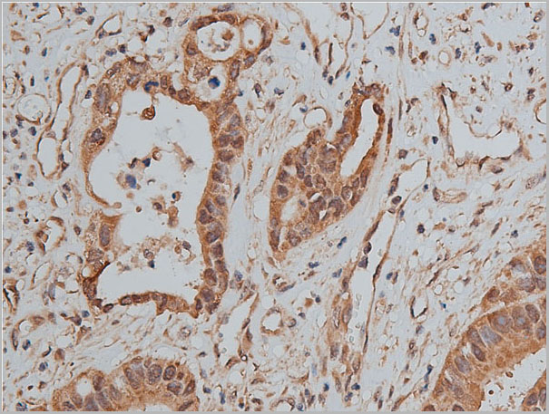 product-image-AAA31079_IHC3.jpg