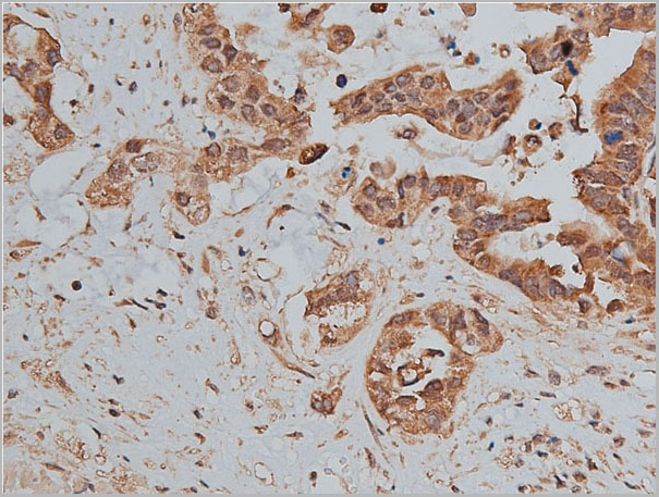 product-image-AAA31079_IHC5.jpg