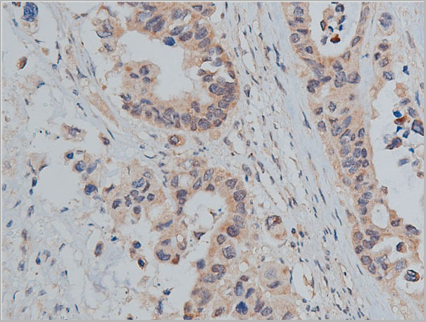 product-image-AAA31079_IHC7.jpg