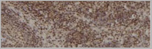 product-image-AAA31081_IHC4.jpg