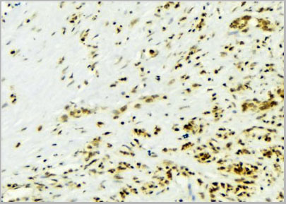 product-image-AAA31086_IHC2.jpg