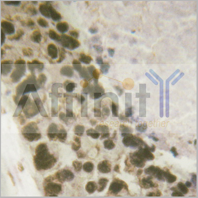 product-image-AAA31087_IHC4.jpg