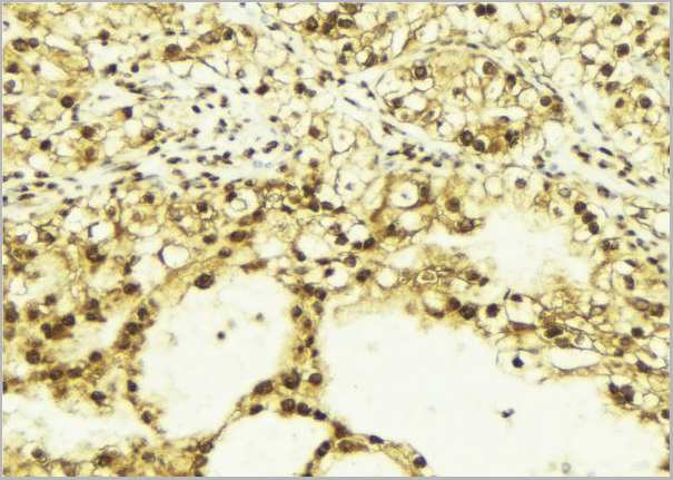 product-image-AAA31087_IHC6.jpg