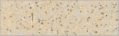 product-image-AAA31098_IHC2.jpg
