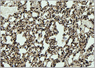 product-image-AAA31100_IHC2.jpg