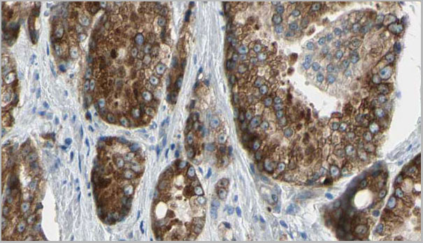 product-image-AAA31102_IHC2.jpg