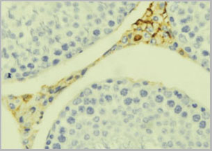 product-image-AAA31103_IHC2.jpg